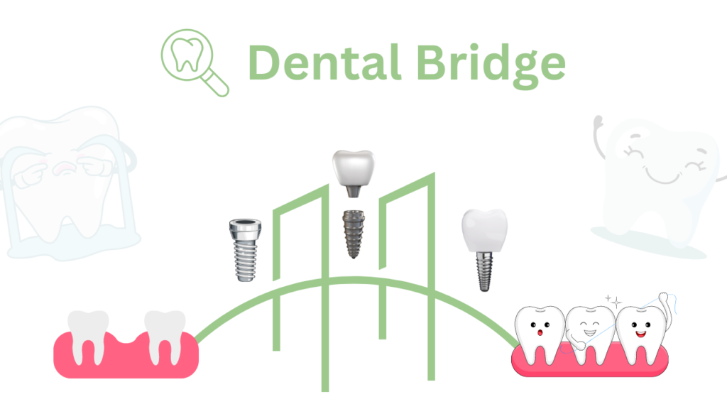 dental bridge cost, dental bridge, tooth bridge, denture bridge cost, mouth bridge cost, tooth bridge cost, dental bridge cost uk, cost of dental bridge, tooth bridge cost uk, bridge work dental cost, dental bridge price, 3 tooth bridge cost uk, cost of a bridge dental, teeth bridge cost, how much is a dental bridge, bridgework teeth, how much is a bridge for teeth, single tooth bridge price, 6 tooth bridge cost uk, tooth bridge vs implant, cost of bridge work, how much does a bridge cost, how much does a dental bridge cost, bridges and implants dental, bridge dental work prices, how much does it cost for dental bridge, implant and bridge, bridge tooth implant, bridgework dental, bridge teeth price, Bury St Edmunds, Dental Bridge Cost in Bury St Edmunds, Dental Bridge Cost, bridge work dental cost,dental bridge cost uk, types of dental bridge, replace missing teeth, gum disease, side of the gap, false tooth, healthy teeth, teeth on either side, dental crowns, bridges the gap, false teeth, surrounding teeth, tooth decay, natural tooth, remaining teeth, temporary bridge, supporting teeth, dental bridge procedures, partial dentures, restore your smile, tooth or teeth,