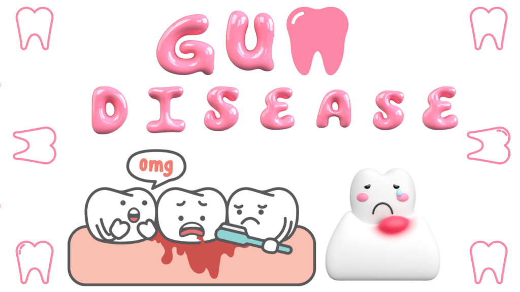 Gum Disease Treatment in Bury St Edmunds, Gum Disease Treatment, Gum Disease, Gum Disease in bury st edmunds, diseased gum in Bury St Edmunds, gingivitis symptoms in Bury St Edmunds, inflamed gums in Bury St Edmunds, gum disease symptoms in Bury St Edmunds, periodontal gum treatment in Bury St Edmunds, gum treatment in Bury St Edmunds, laser gum treatment in Bury St Edmunds, periodontal surgery in Bury St Edmunds, gum line in Bury St Edmunds, dental treatments in Bury St Edmunds, oral Health in Bury St Edmunds,