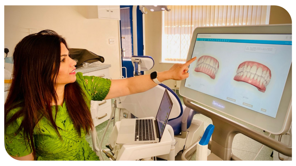 scanner for Invisalign, itero for Invisalign, Invisalign bury st edmunds, best Invisalign scanner, itero, itero scanner, dental scanner, teeth scanner, digital scanner, dental 3d scanner, smile design, itero in bury st edmunds, itero scanner in bury st edmunds, dental scanner in bury st edmunds, teeth scanner in bury st edmunds, digital scanner in bury st edmunds, dental 3d scanner in bury st edmunds, smile design in bury st edmunds, itero the thatch dental, itero scanner the thatch dental, What is iTero in dentistry, What is the cost of iTero, iTero Dental Impressions, Discover 5 Benefits Of iTero 3D Scanning Dental, iTero: Intraoral Scanners for Restorative and Orthodontic, How Does iTero Scanner Work, iTero Login, iTero contact, iTero scanner Invisalign,