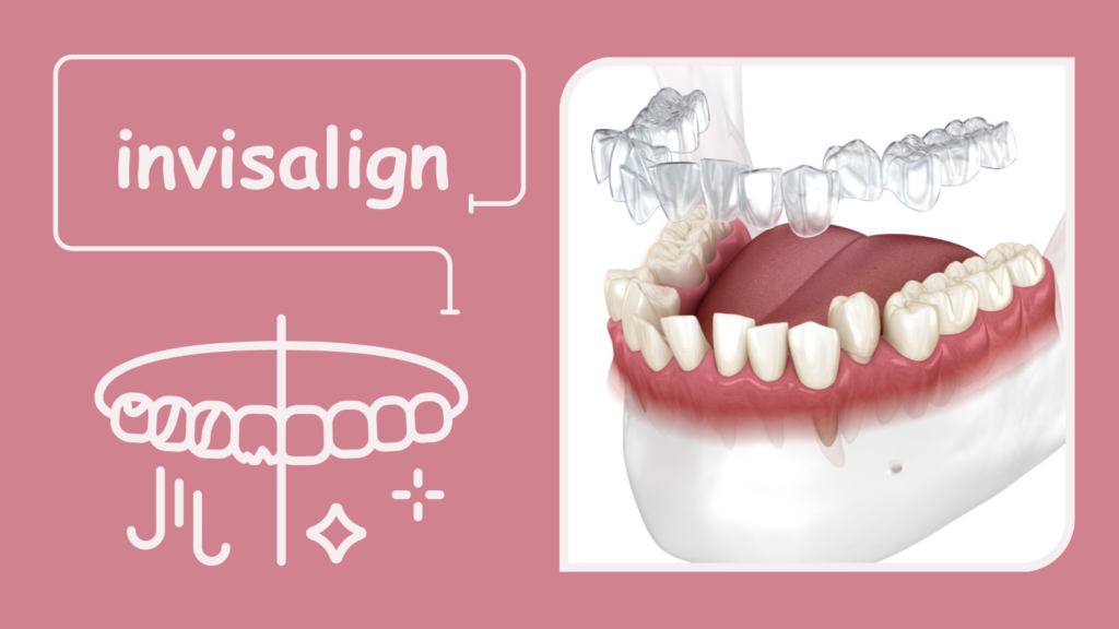 Invisalign cost in bury st edmunds, What are the benefits of getting invisalign, Invisalign in bury st edmunds, Invisalign treatment in bury st edmunds, Invisalign cost bury st edmunds