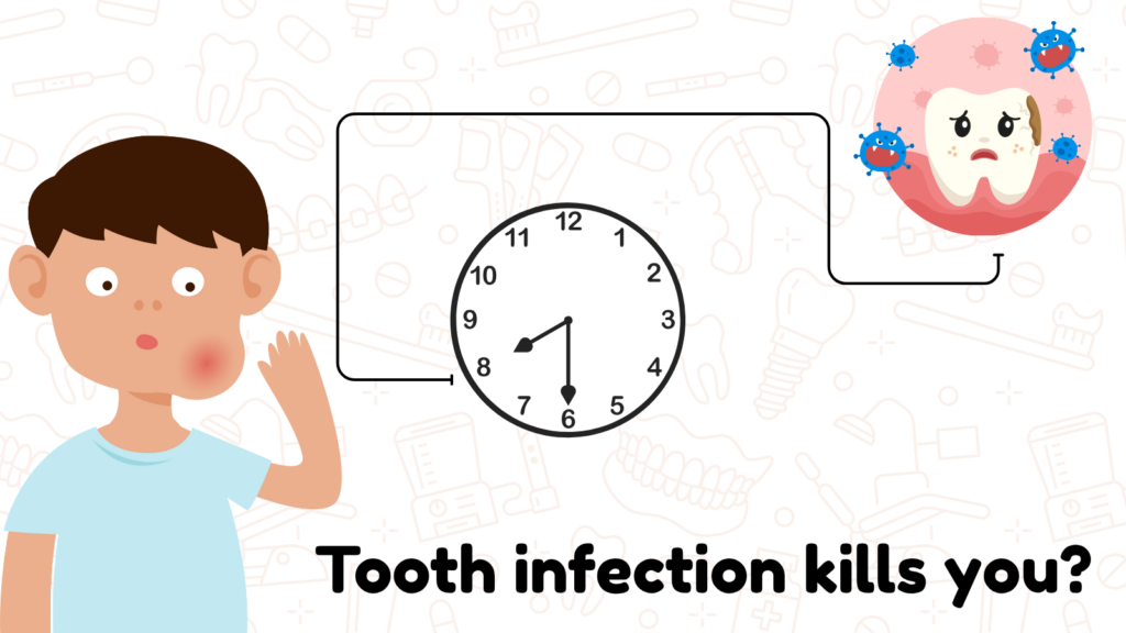 How long until a tooth infection kills you, How long until a tooth infection kills you Bury st edmunds, signs of tooth infection , toothache infection, tooth infection symptoms, can a abscessed tooth kill you, how to tell if you have infected tooth, How Quickly Can a Tooth Infection Become Life-Threatening, Can a Tooth Infection Kill You — and How Long Would It Take, The Timeline: When a Tooth Infection Turns Deadly, From Pain to Fatal — How Long Does a Tooth Infection Take to Kill, Tooth Infection Danger: How Fast Can It Turn Fatal,