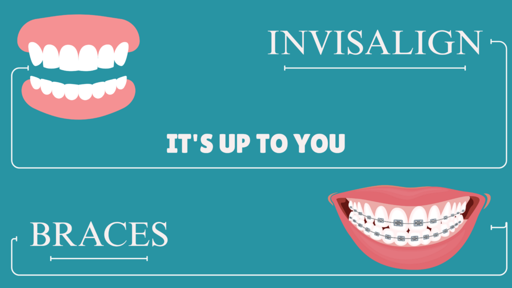 Invisalign vs braces in bury st edmunds, How much is Invisalign, How much does Invisalign cost, How much is Invisalign UK, How long does Invisalign take, How does Invisalign work, How to clean Invisalign, What is Invisalign refinement, Invisalign refinement, How much is Invisalign in bury st edmunds, Invisalign refinement in bury st edmunds, braces in bury st edmunds,